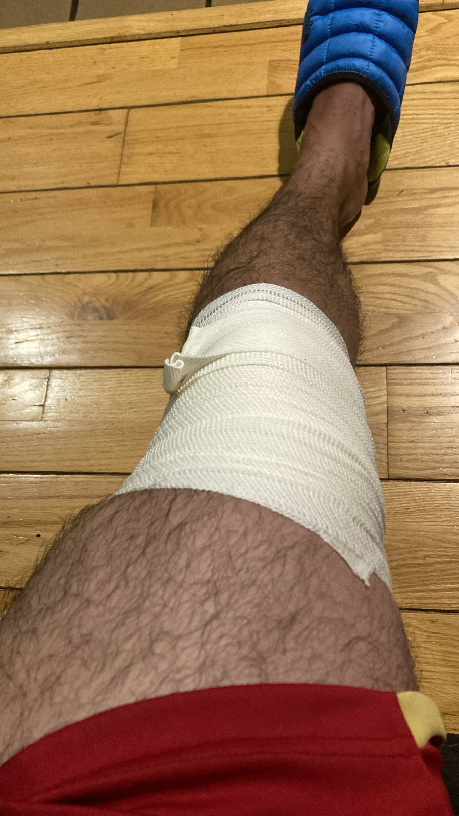 El día de la&nbsp;lesión