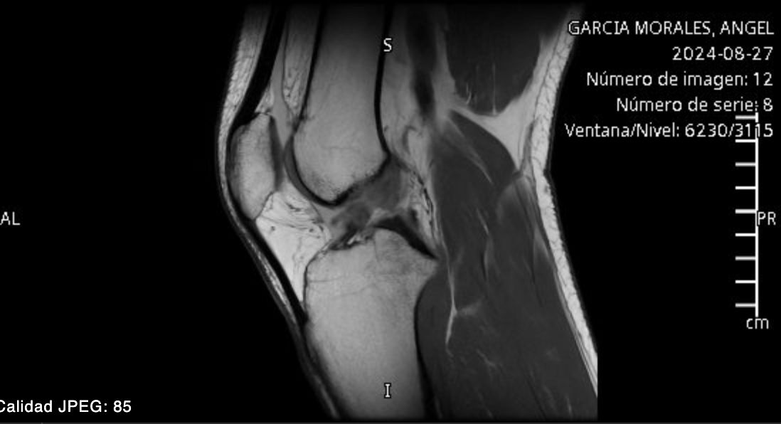 Crónicas de la pata cucha